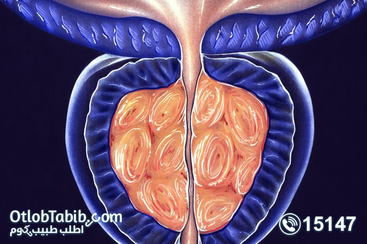 Prostatitis and erection..and how to treat and diagnose